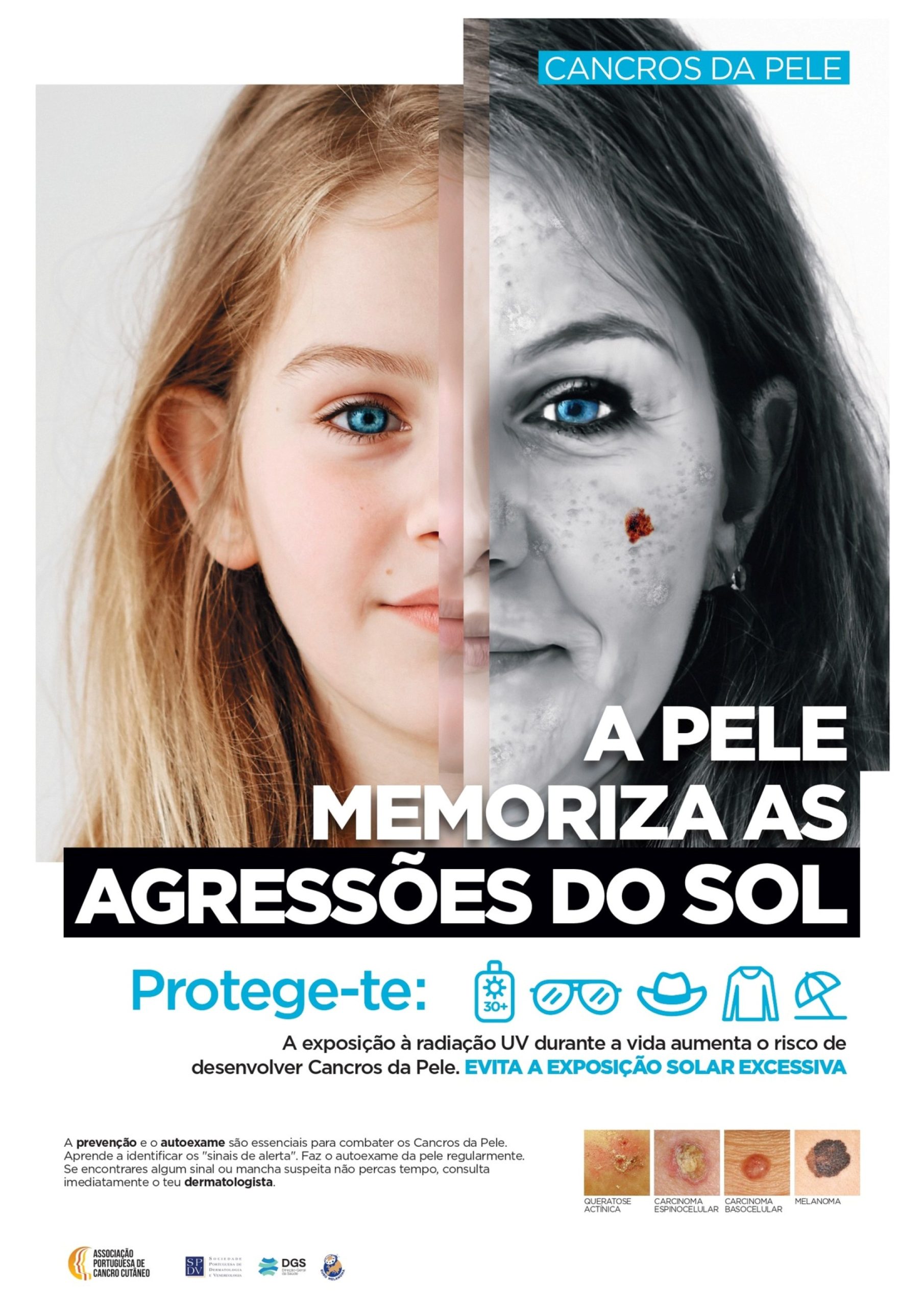 Cuide e proteja a sua pele! “Pele e Sol 2025”